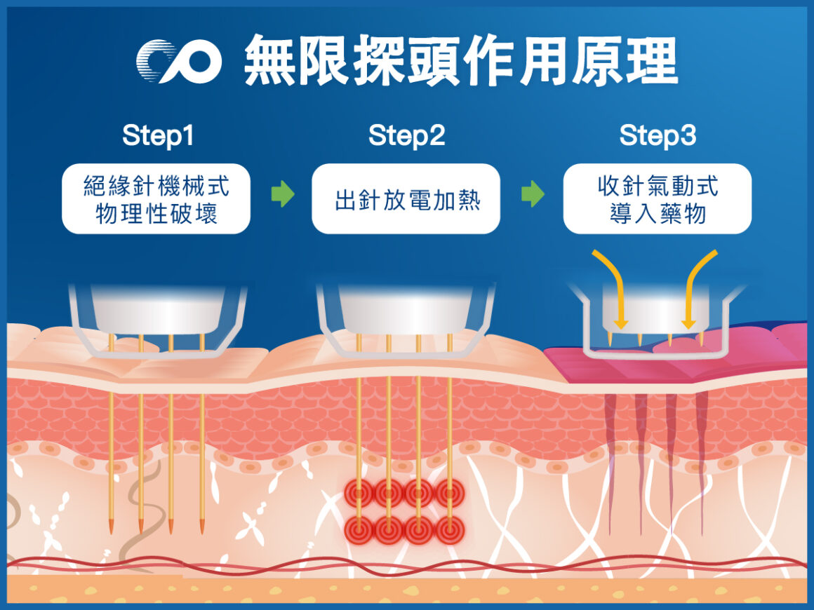 無限探頭作用原理