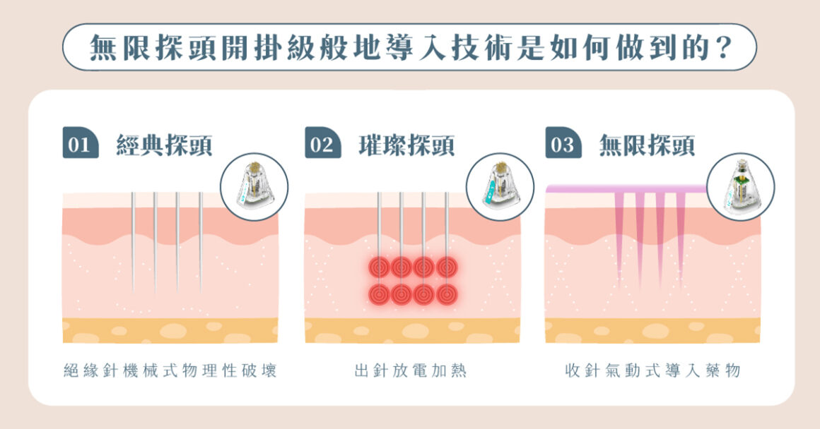 無限探頭電波是如何導入的？